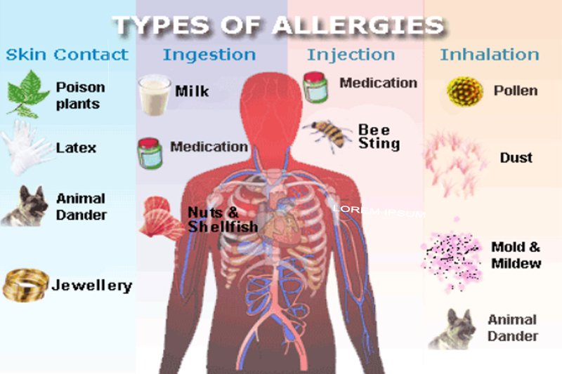 types of Allergies