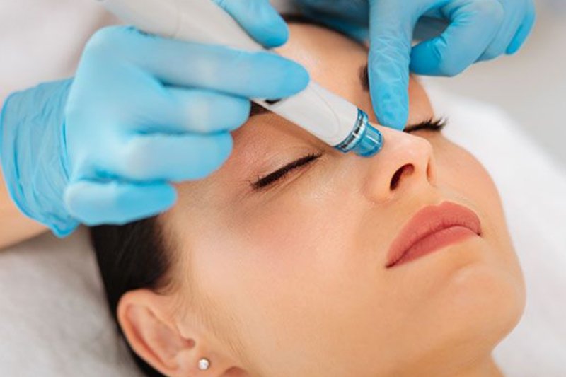 hydrafacial treatment