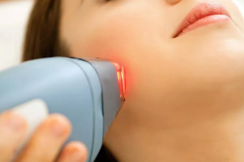 laser procedure on face