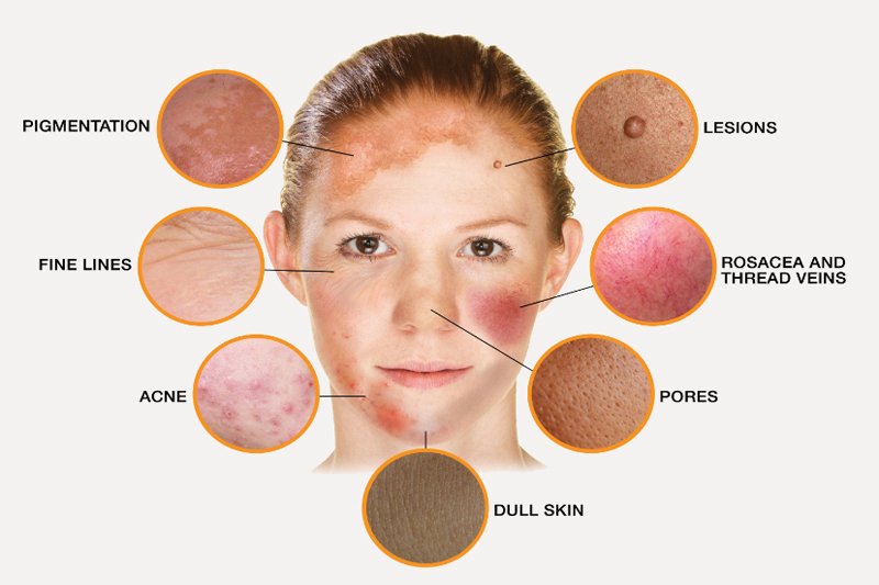 skin specialist diseases round on face