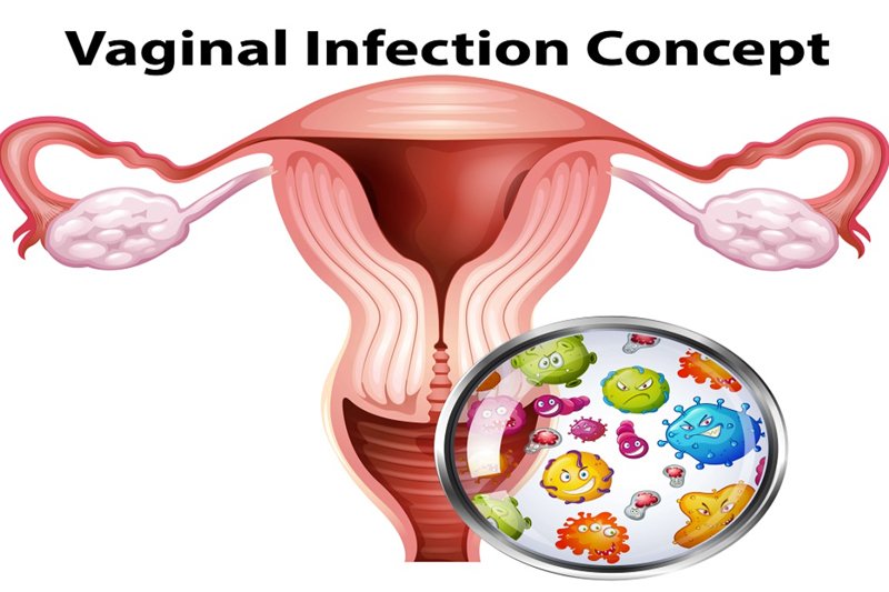 vaginal infection concepts